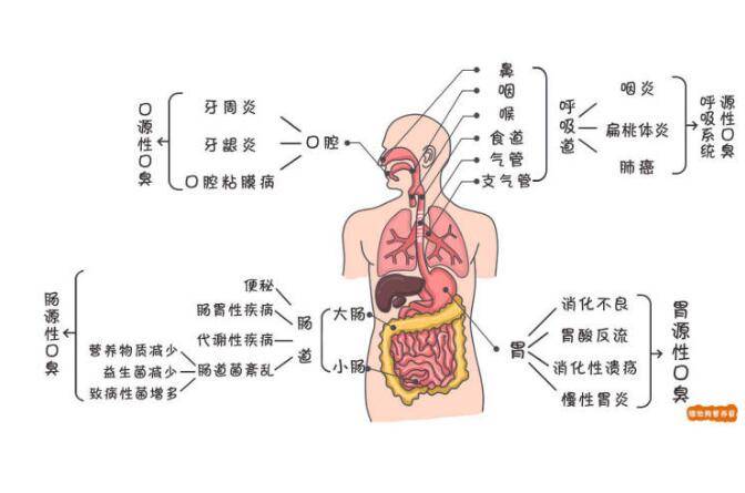 如何解决口臭的方案?湿气重引起的口臭去除方法